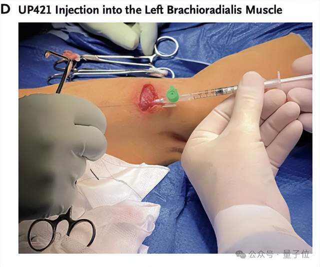 分泌胰岛素的细胞_胰岛细胞中与胰岛素_