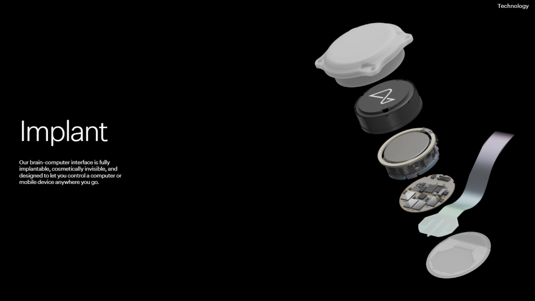 _马斯克脑机接口“一号受试者”:正重新夺回人生的独立_马斯克脑机接口“一号受试者”:正重新夺回人生的独立