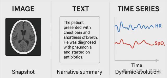 微软发布医疗时序基座模型：4540亿数据预训练，解决不规则采样