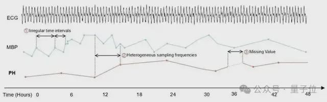 _微软发布医疗时序基座模型：4540亿数据预训练，解决不规则采样_微软发布医疗时序基座模型：4540亿数据预训练，解决不规则采样