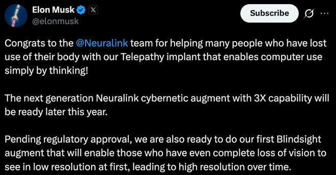 _马斯克脑机接口，靠意念玩游戏只是基操，下一代设备性能翻三倍_马斯克脑机接口，靠意念玩游戏只是基操，下一代设备性能翻三倍