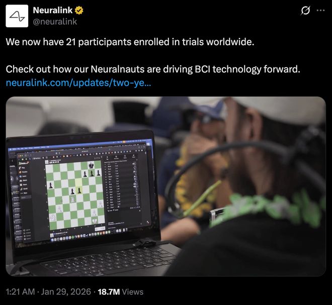 马斯克脑机接口，靠意念玩游戏只是基操，下一代设备性能翻三倍__马斯克脑机接口，靠意念玩游戏只是基操，下一代设备性能翻三倍